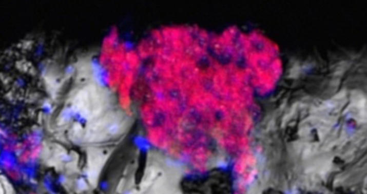 ABŞ-nin bu ştatında ölümcül bakteriya ilə bağlı xəbərdarlıq edildi