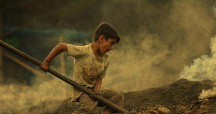 Sevgilimin başında bit yoxdur