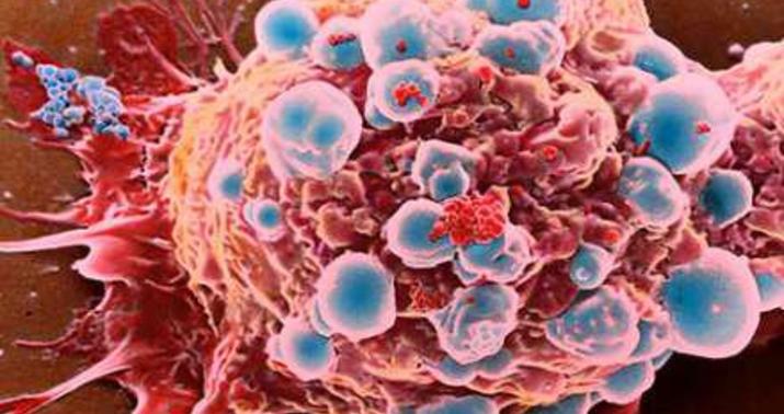 COVİD xərçəngin müalicəsinə təkan verə bilər -