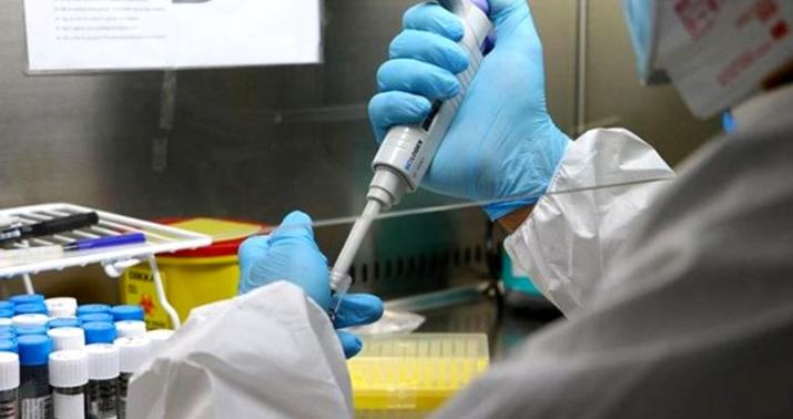 Korona peyvəndi ilə bağlı mühüm açıqlama: