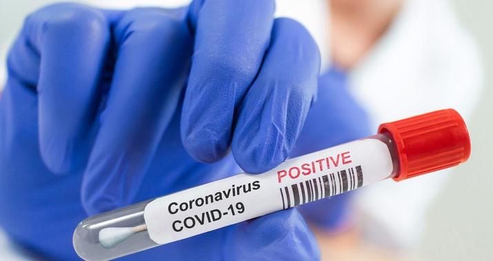 Bakı və bölgələr üzrə COVID-19-a yoluxma faizi açıqlandı