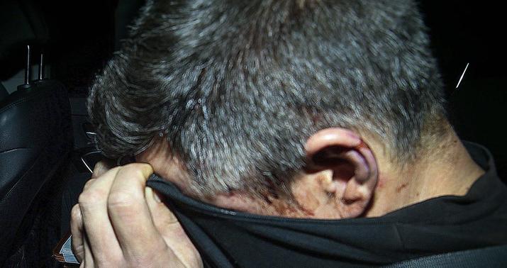 Mingəçevirdə silahlı cinayət törədən şəxslərlə bağlı –