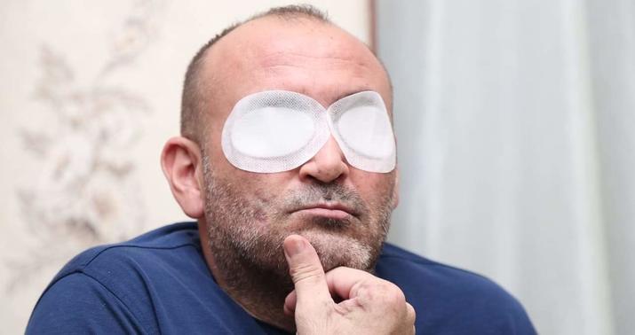 İki gözünü, ayağını itirən qazimiz: "Dünyada 3-cü ola bilər..."  -