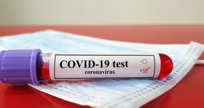 Azərbaycanda daha 603 nəfər koronavirusa yoluxdu