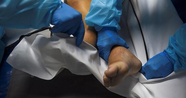 ABŞ-da koronadan ölənlərin sayı 735 mini keçdi