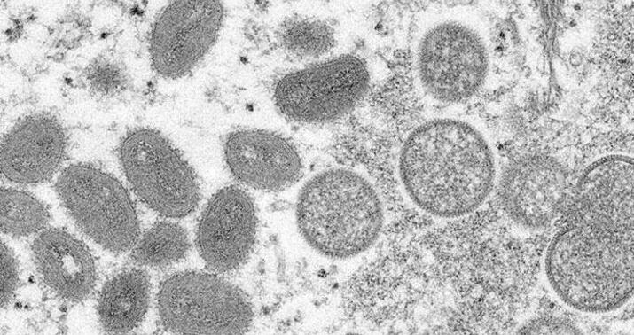 Meymunçiçəyi ilə bağlı yeni xəbər: Artım var... -