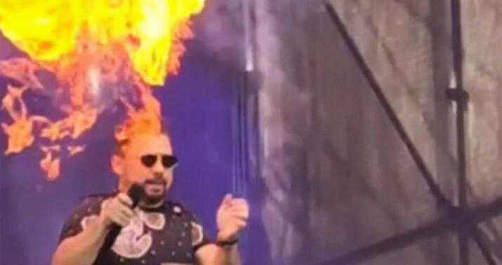 Müğənni səhnədə çıxış edərkən yandı