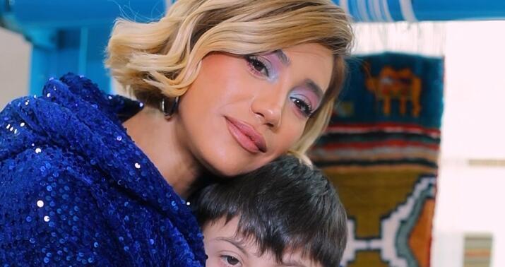 Röya Ayxan daun sindromlu uşaqlarla görüşdü -