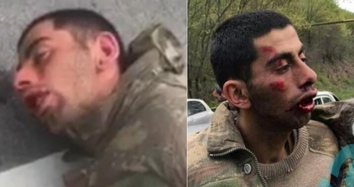 Hərbi qulluqçumuza işgəncə verilməsi faktı ilə bağlı cinayət işi başlandı -