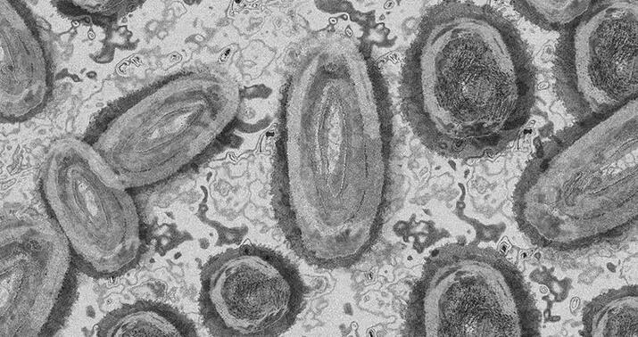 ÜST-dən yeni virus xəbərdarlığı