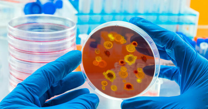 İsveçdə meymunçiçəyi virusu qeydə alındı