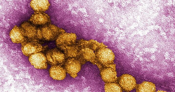 Ermənistanda qorxunc virus yayılır –