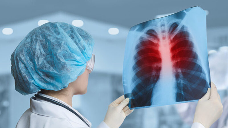 İlin əvvəlindən indiyədək 3 mindən çox şəxs vərəmə yoluxub -