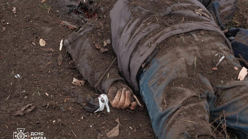 Rusiyanın Kiyevə hücumu nəticəsində yaralananların sayı 37-yə çatdı -