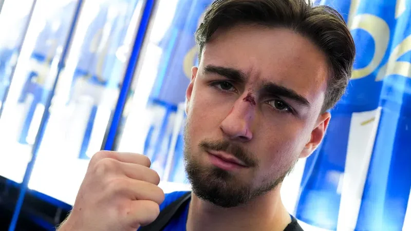 Oyuna burnu sınıq halda davam etdi, gündəm oldu