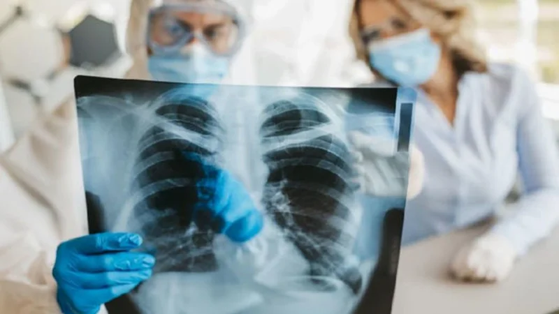 Parlamentdə vərəmlə bağlı ictimai dinləmə keçiriləcək