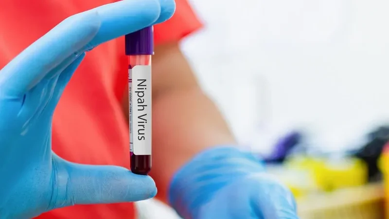 Hindistanda "Nipah" virusunun yayılmasının qarşısını almağa çalışırlar