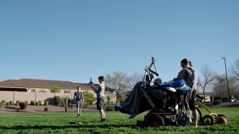 İlon Maskın "Neuralink" şirkəti iki illik klinik sınaqların nəticələrini açıqlayıb