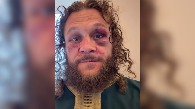 Rafael Fiziyevdən məğlubiyyət şərhi: