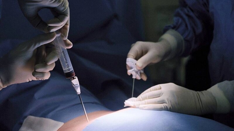 Sümük iliyinə ehtiyac duyan xəstələrin sayı açıqlandı -