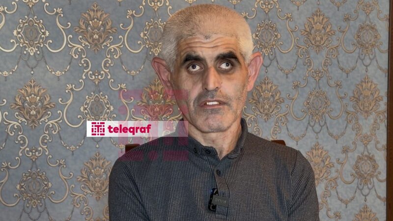 Möcüzəvi yaddaş: Anadangəlmə görmə əngəlli şəxs saniyələr ərzində hesablama aparır -