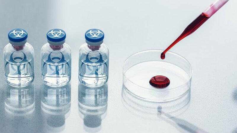 ABŞ Milli Kəşfiyyatı indiyə qədər gizlədilən bioloji laboratoriyaların sayını açıqladı