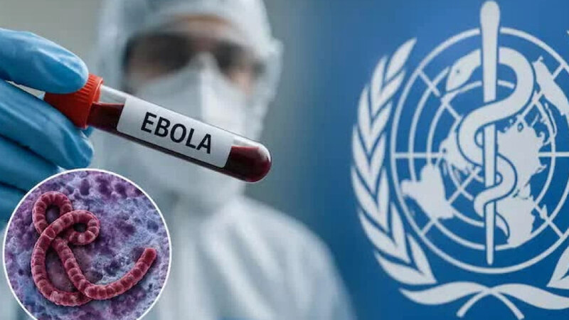 Nigeriyada aşkarlanan Ebola virusu ilə bağlı yeni fakt açıqlandı