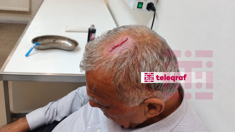 Şəkidə icra nümayəndəsi bələdiyyə sədrinin başına butulka çırpıb –
