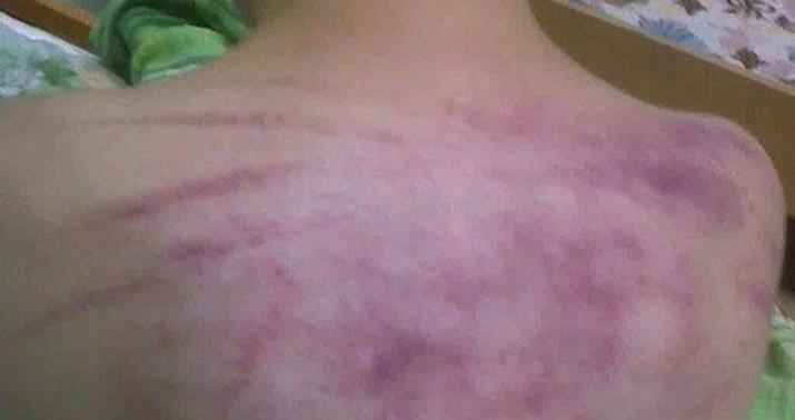 İnternatda uşaqlara dəhşətli işgəncə - FOTO/18+