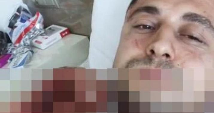 Feysbukun canlı yayımında intihar etdi - FOTO