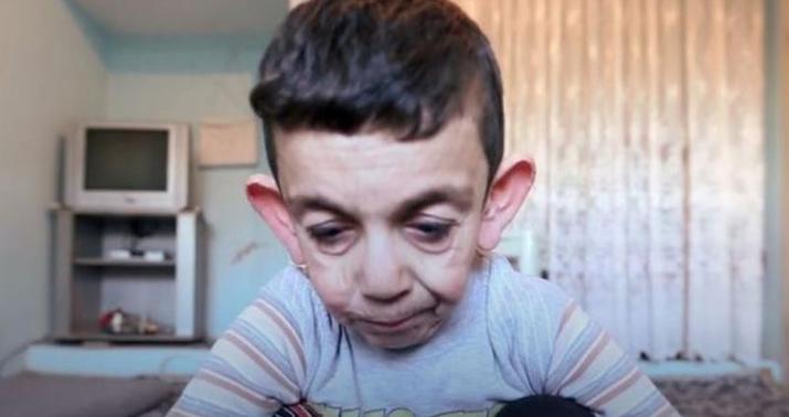 Suriya müharibəsinin qocaltığı 7 yaşlı uşaq  -  FOTO