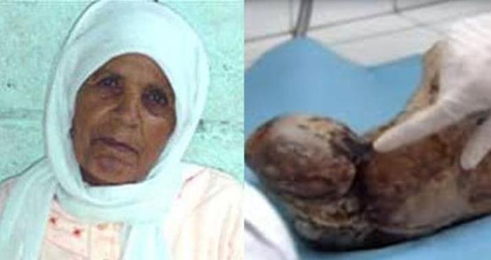O dünyanı görüb gələnlər: İNANILMAZ FAKTLAR - FOTO