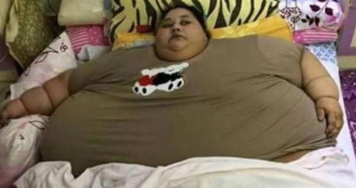 Qadın 3 həftəyə 100 kq arıqladı  - FOTO