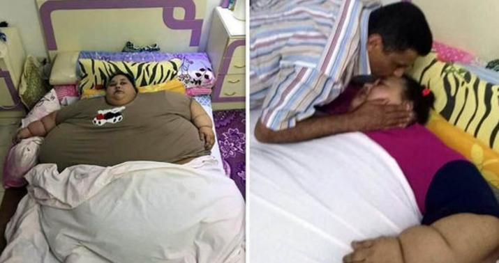 5 həftəyə 140 kilo arıqladı - FOTO